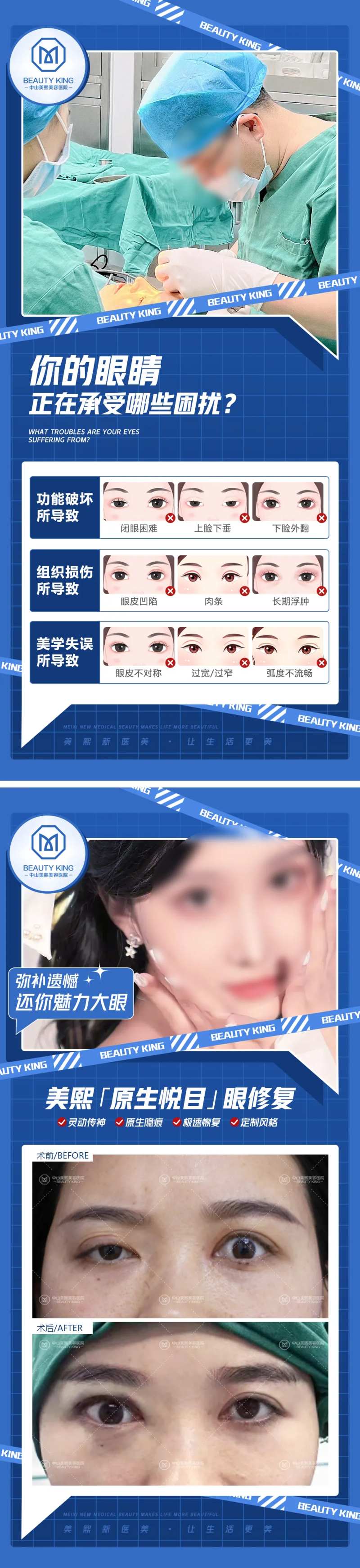 眼修复案例系列-采灵感-cailinggan.com