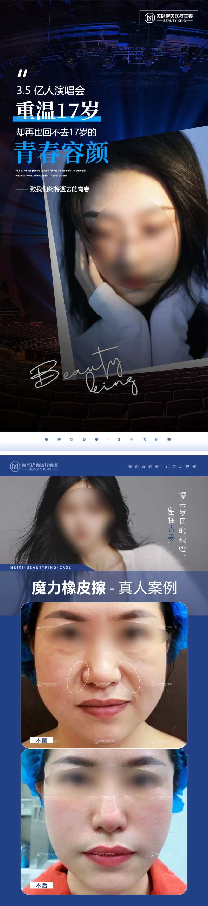 医美致青春系列海报-采灵感-cailinggan.com