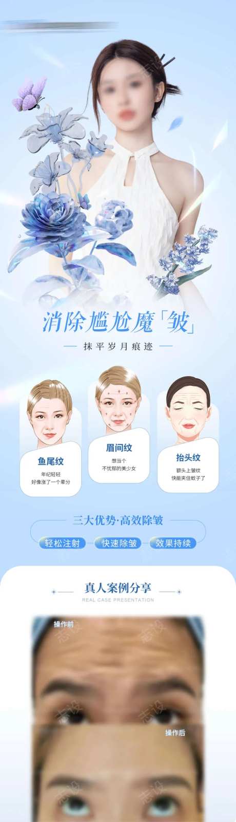 医美除皱针案例海报-采灵感-https://www.cailinggan.com/