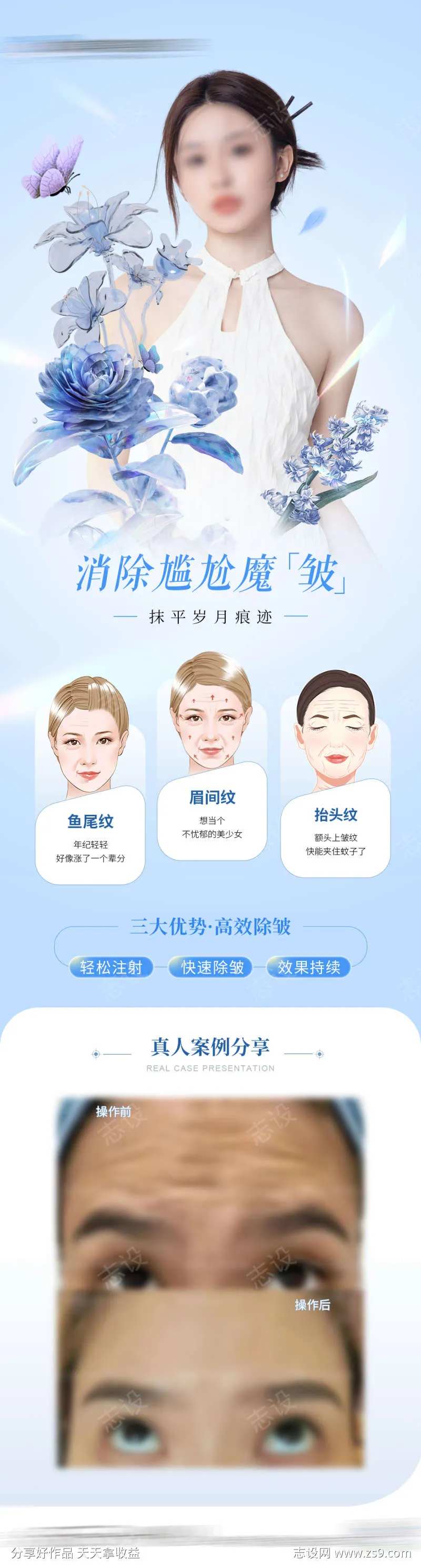 医美除皱针案例海报-采灵感-cailinggan.com