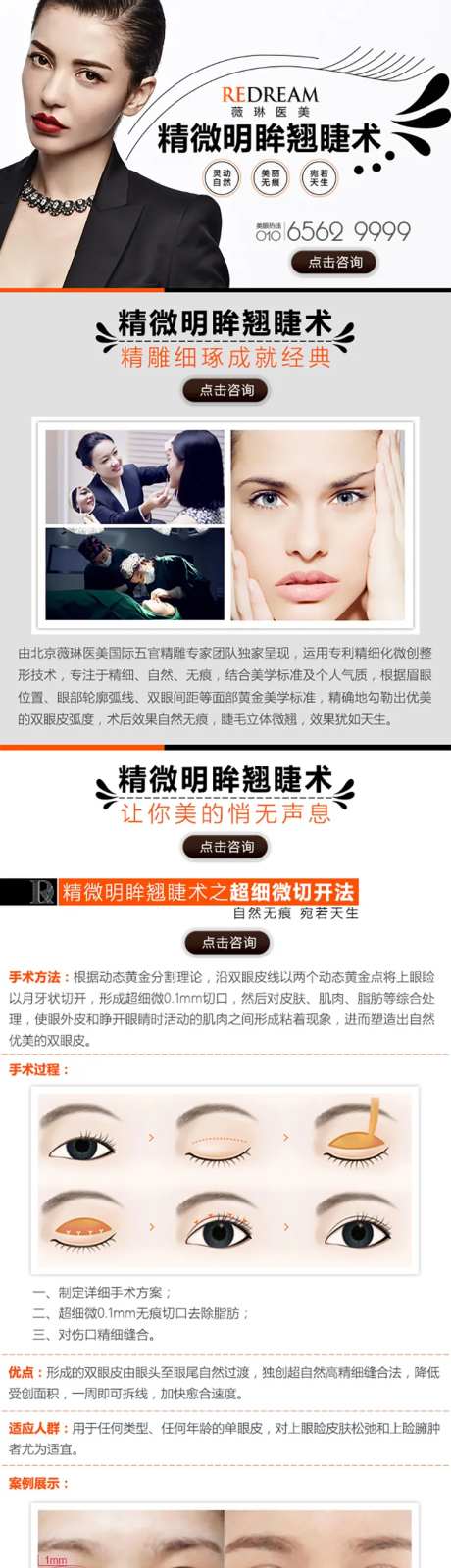 医美双眼皮项目详情页设计-采灵感-https://www.cailinggan.com/
