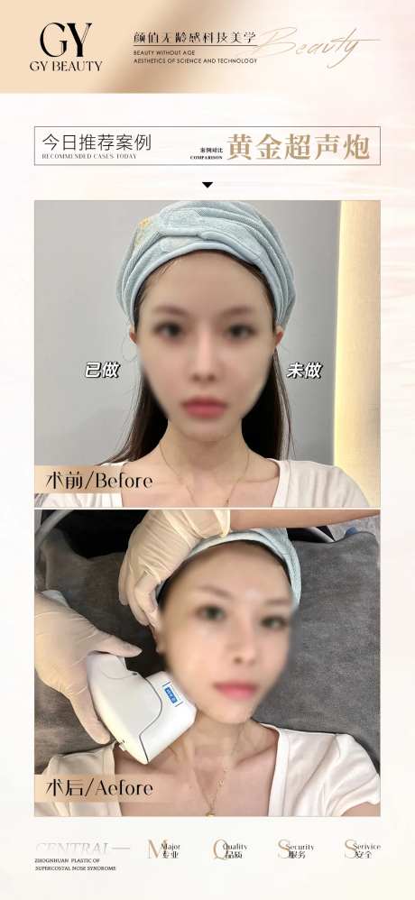 医美对比案例海报-采灵感-https://www.cailinggan.com/