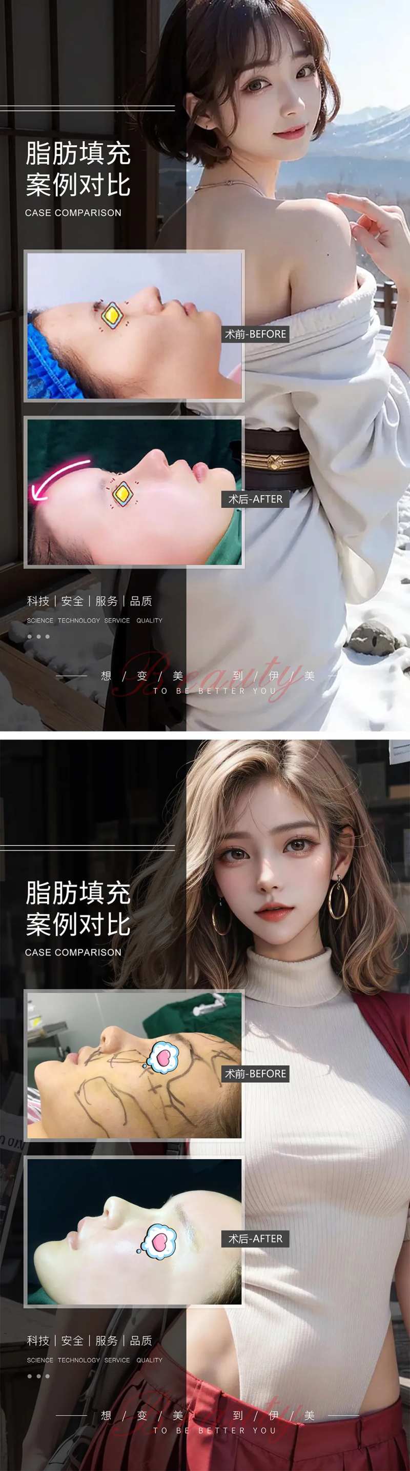 面部脂肪填充案例对比-采灵感-cailinggan.com