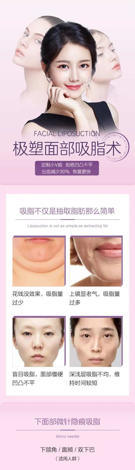 医美面部吸脂详情页-采灵感-https://www.cailinggan.com/