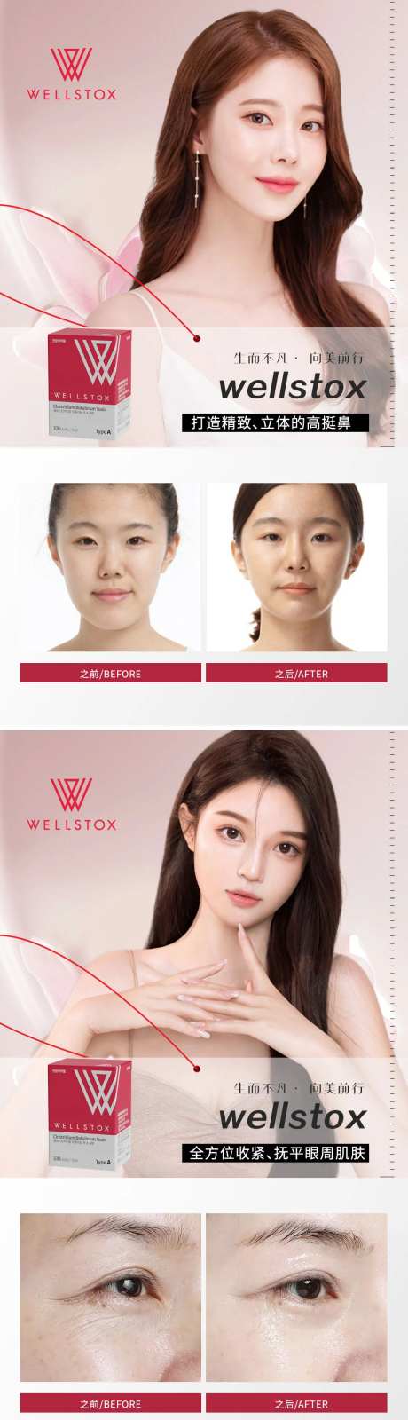 肉毒素案例对比-采灵感-https://www.cailinggan.com/