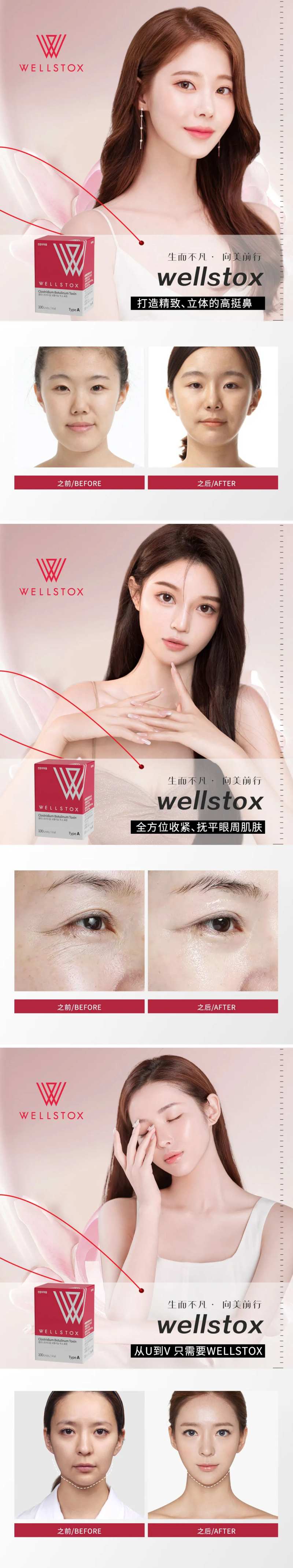 肉毒素案例对比-采灵感-cailinggan.com