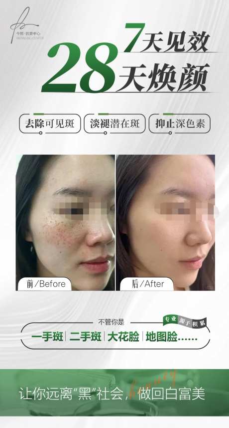 医美祛斑案例前后对比海报-采灵感-https://www.cailinggan.com/