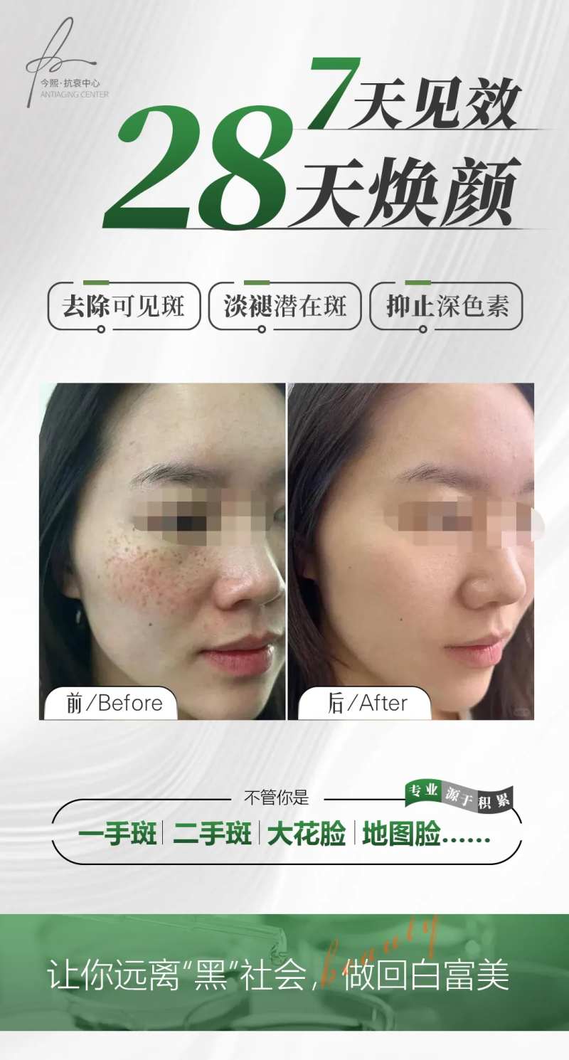 医美祛斑案例前后对比海报-采灵感-cailinggan.com