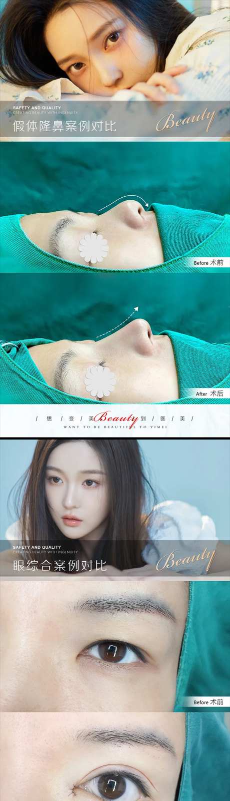 医美案例模板-采灵感-https://www.cailinggan.com/