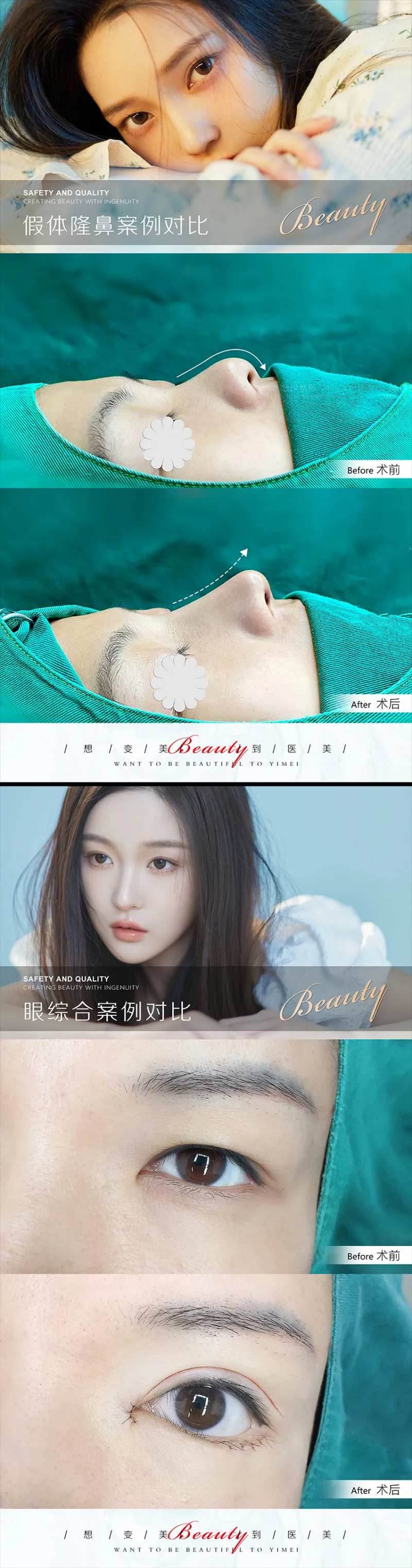 医美案例模板-采灵感-cailinggan.com