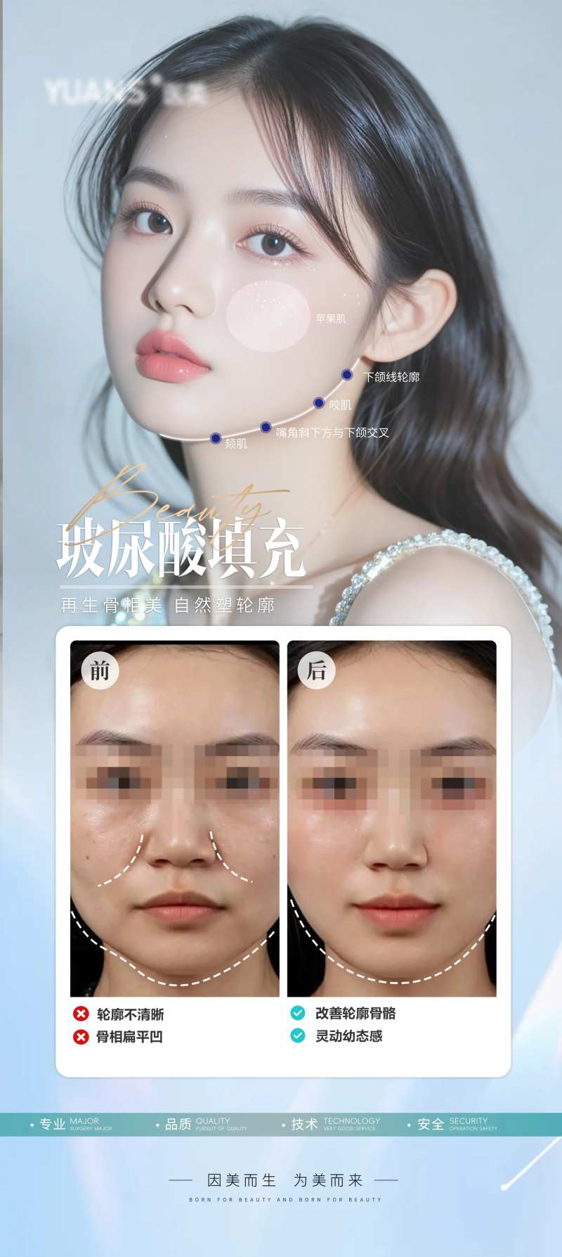 医美玻尿酸填充轮廓案例-采灵感-cailinggan.com