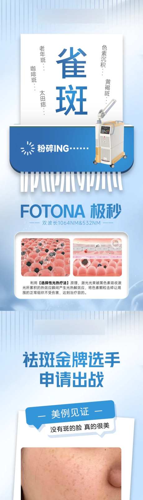 极秒粉碎机-采灵感-https://www.cailinggan.com/