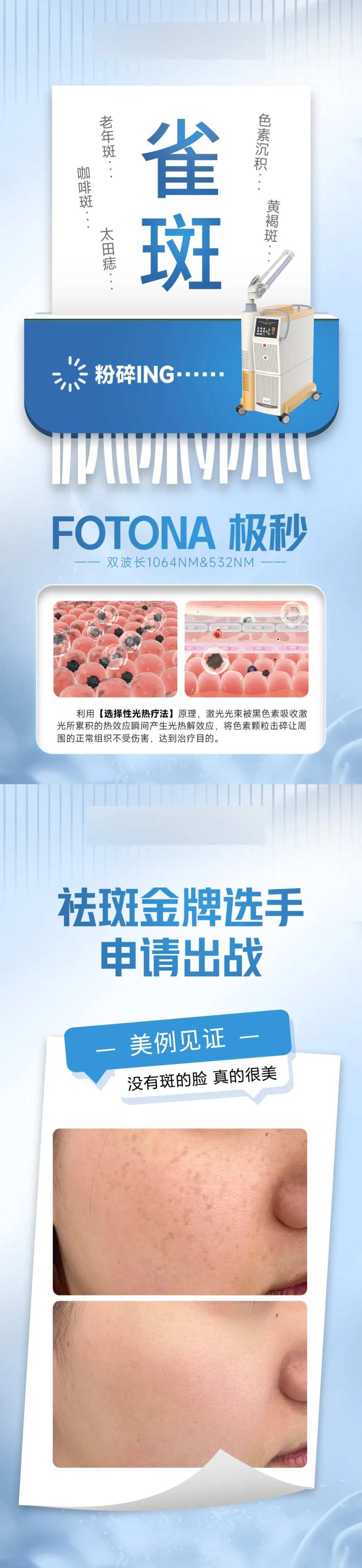 极秒粉碎机-采灵感-cailinggan.com