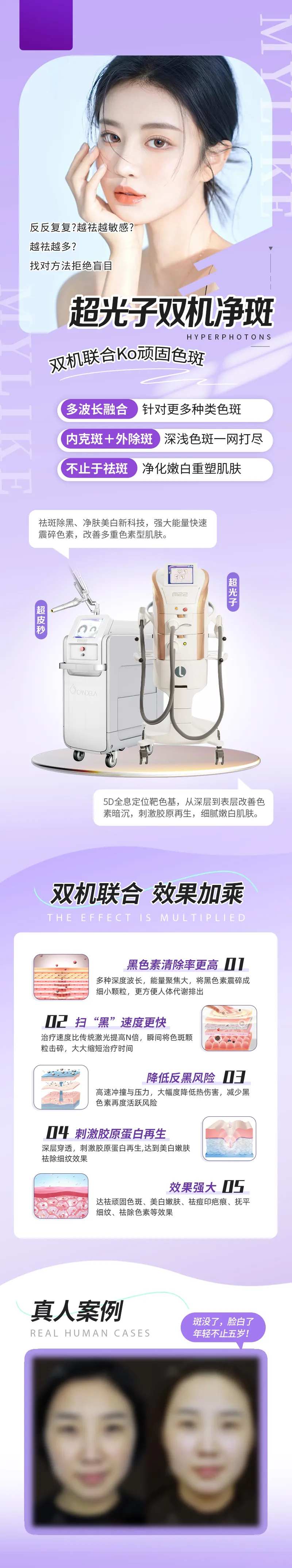 皮肤科双机净斑产品长图-采灵感-cailinggan.com
