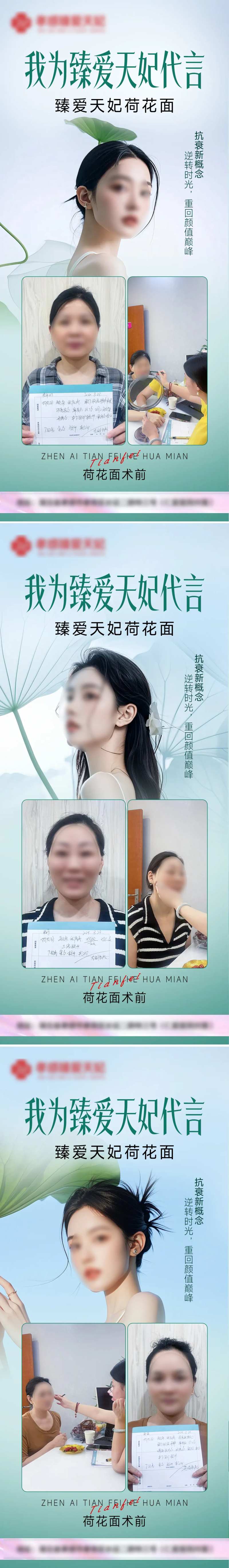 医美面部整形案例代言系列海报-采灵感-cailinggan.com