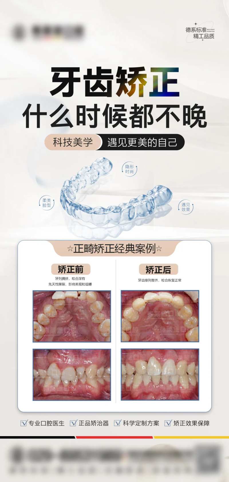 正畸矫正案例-采灵感-cailinggan.com