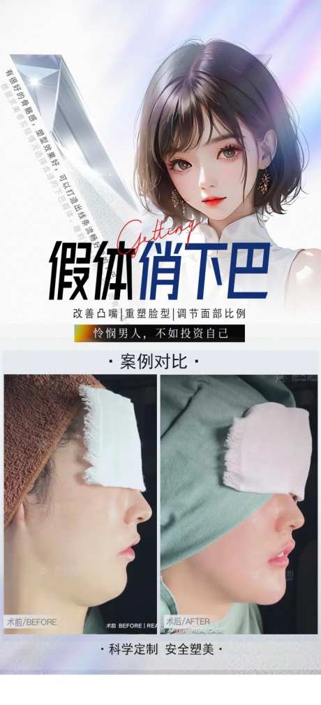 假体下巴整形宣传海报-采灵感-https://www.cailinggan.com/