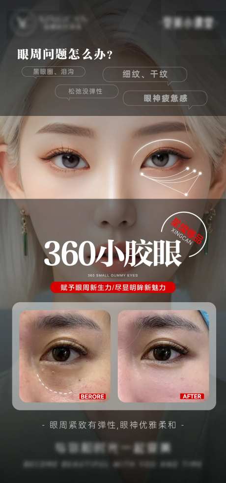 医美眼部问题海报-采灵感-https://www.cailinggan.com/