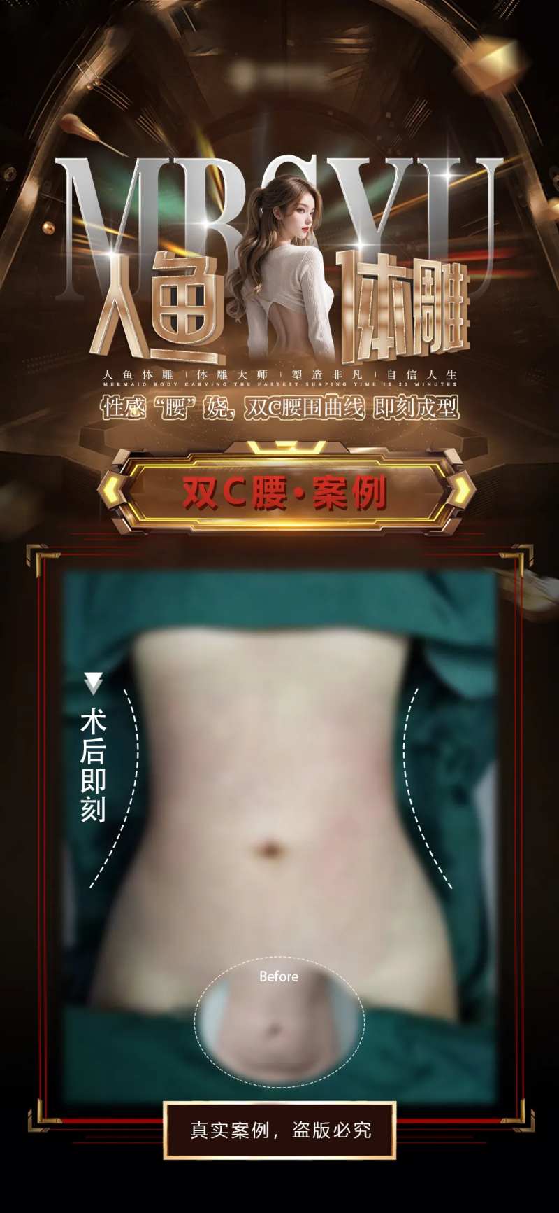 人鱼体雕海报-采灵感-cailinggan.com