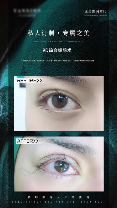 眼综合案例对比绿金海报-采灵感-https://www.cailinggan.com/