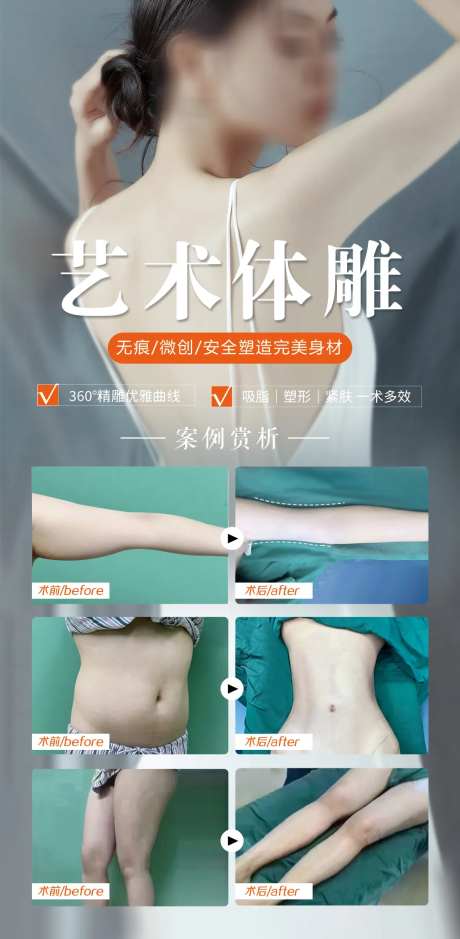 吸脂塑形艺术体雕案例海报-采灵感-https://www.cailinggan.com/