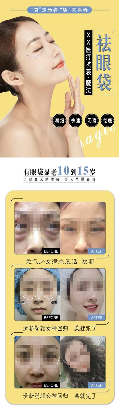 医美祛眼袋海报-采灵感-https://www.cailinggan.com/