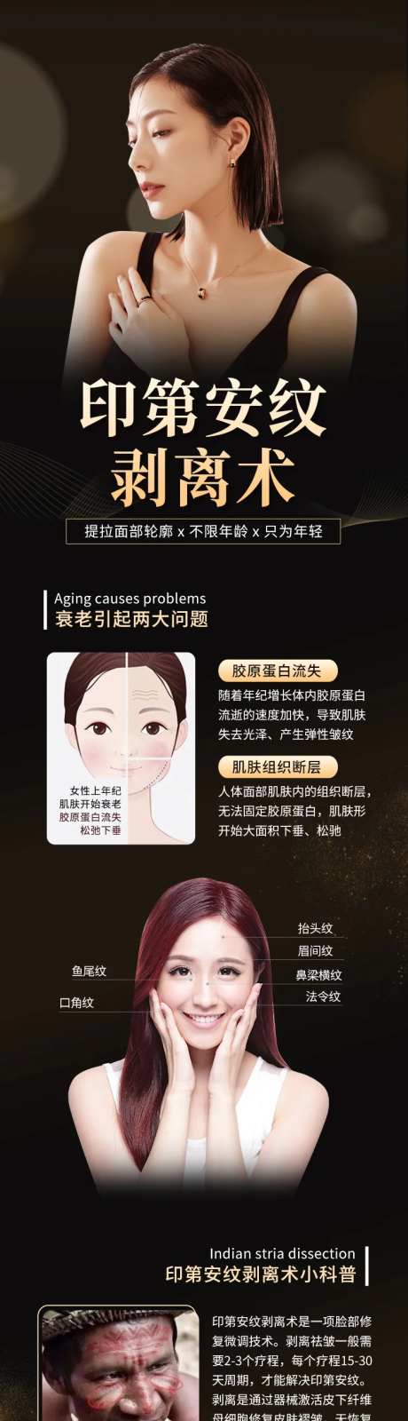 印第安纹剥离术-采灵感-https://www.cailinggan.com/