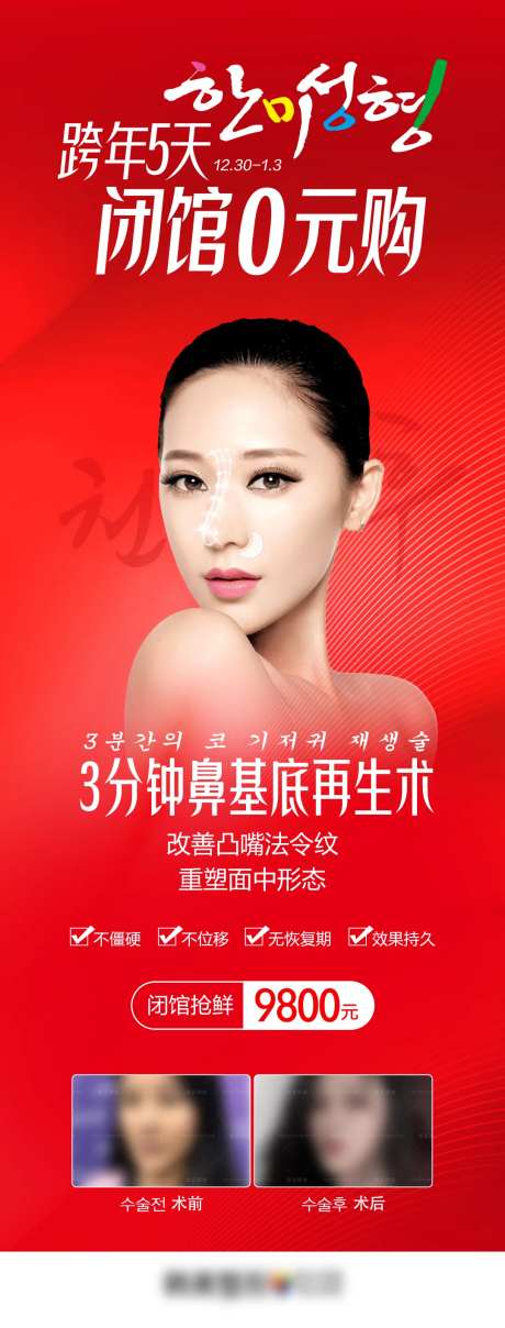 医美鼻整形隆鼻鼻基底再生术-采灵感-https://www.cailinggan.com/