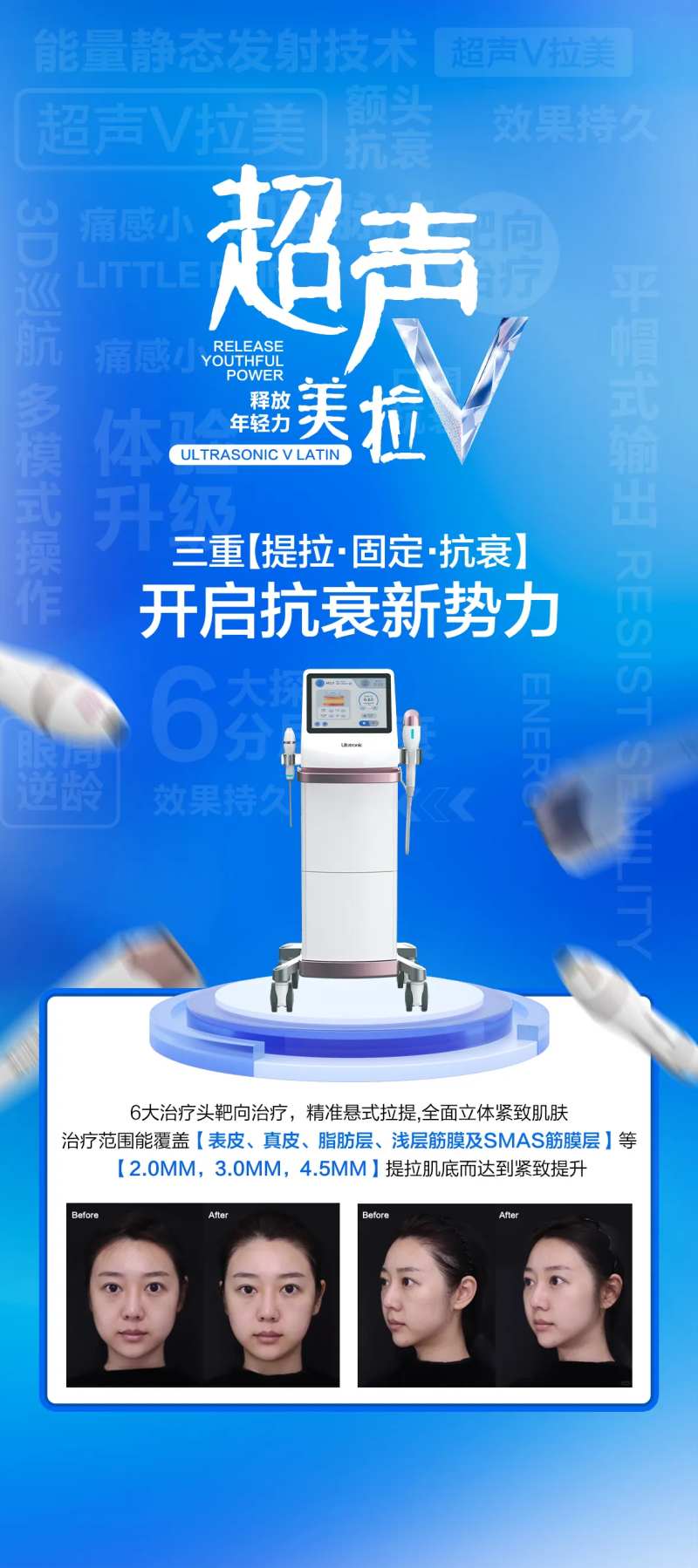 超声V拉美-采灵感-cailinggan.com