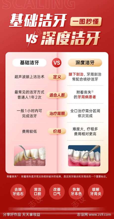 基础洁牙与深度洁牙的区别对比口腔科普-采灵感-https://www.cailinggan.com/