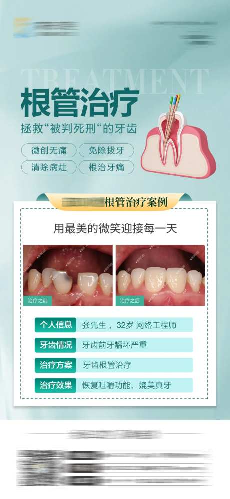 医美口腔牙齿根管治疗对比海报-采灵感-https://www.cailinggan.com/