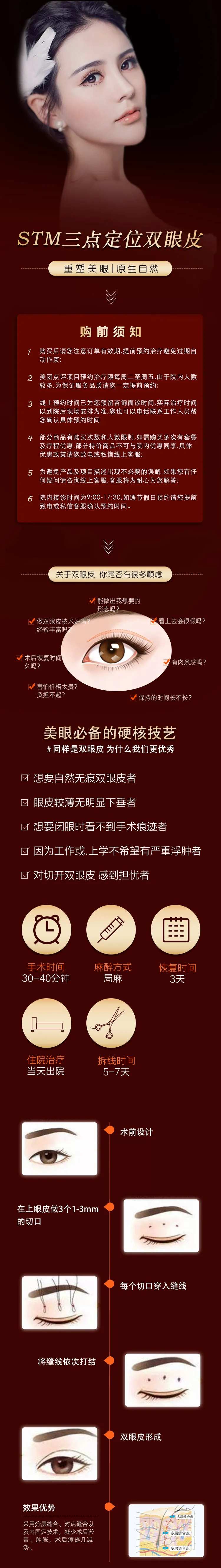 定点双眼皮详情-采灵感-cailinggan.com