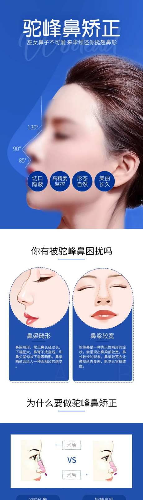 医美驼峰鼻矫正详情页长图-采灵感-https://www.cailinggan.com/
