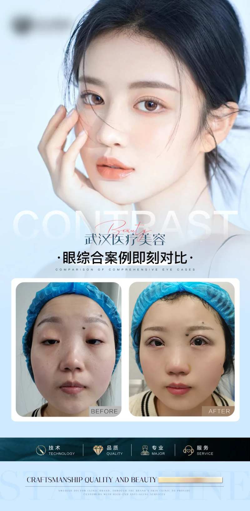 双眼皮模特案例-采灵感-cailinggan.com