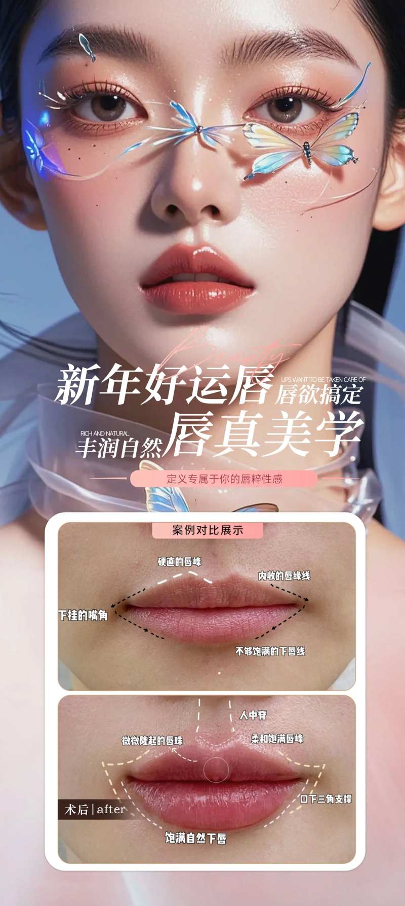 新年好运唇海报-采灵感-cailinggan.com