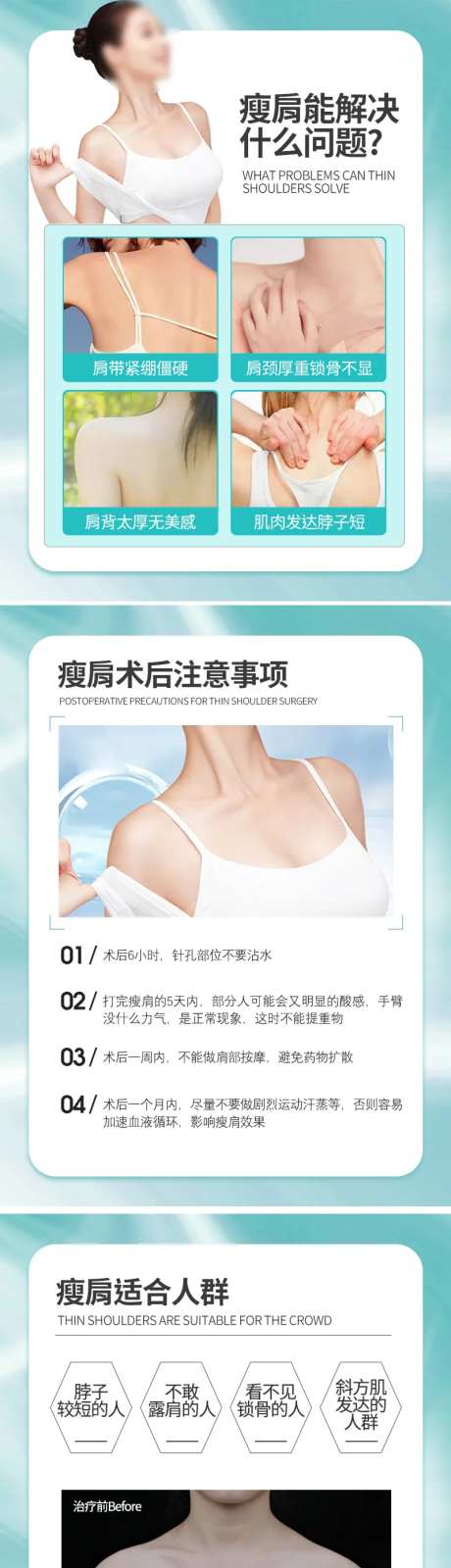 瘦肩术后科普海报-采灵感-https://www.cailinggan.com/