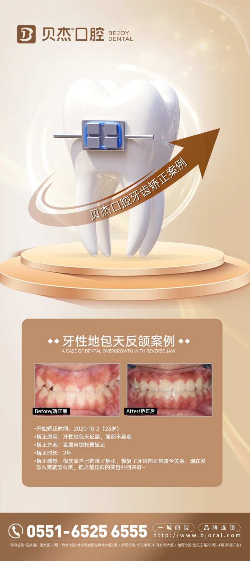 口腔金属矫正海报-采灵感-cailinggan.com
