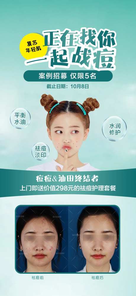 祛痘招募朋友圈海报-采灵感-https://www.cailinggan.com/