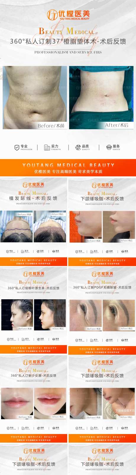 医美案例对比图系列海报-采灵感-https://www.cailinggan.com/