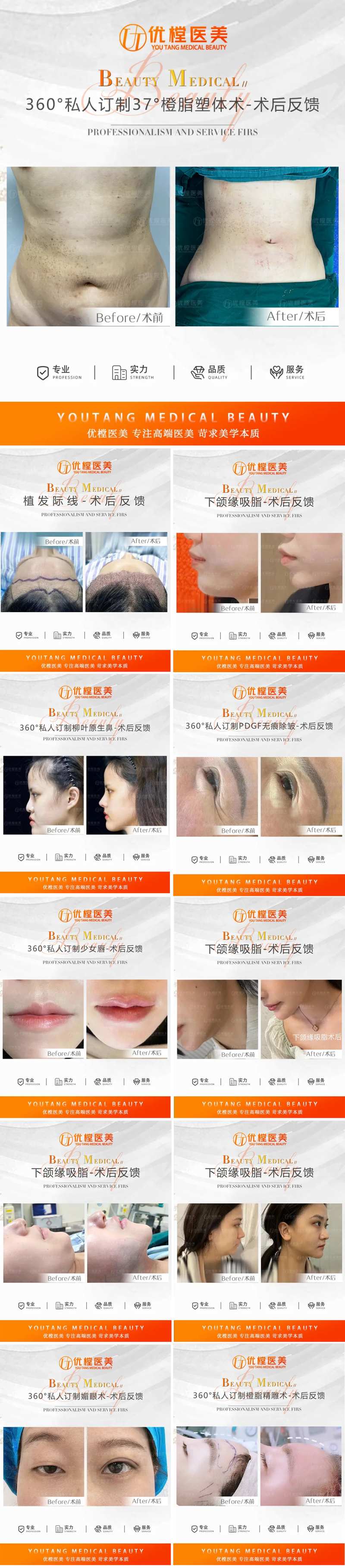 医美案例对比图系列海报-采灵感-cailinggan.com