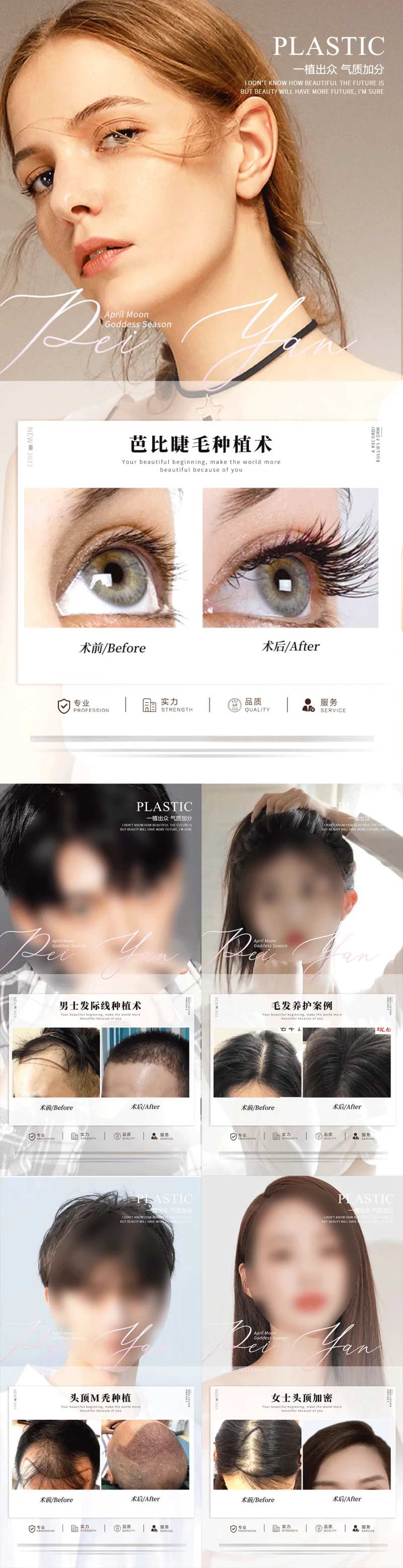 植发案例合集-采灵感-cailinggan.com
