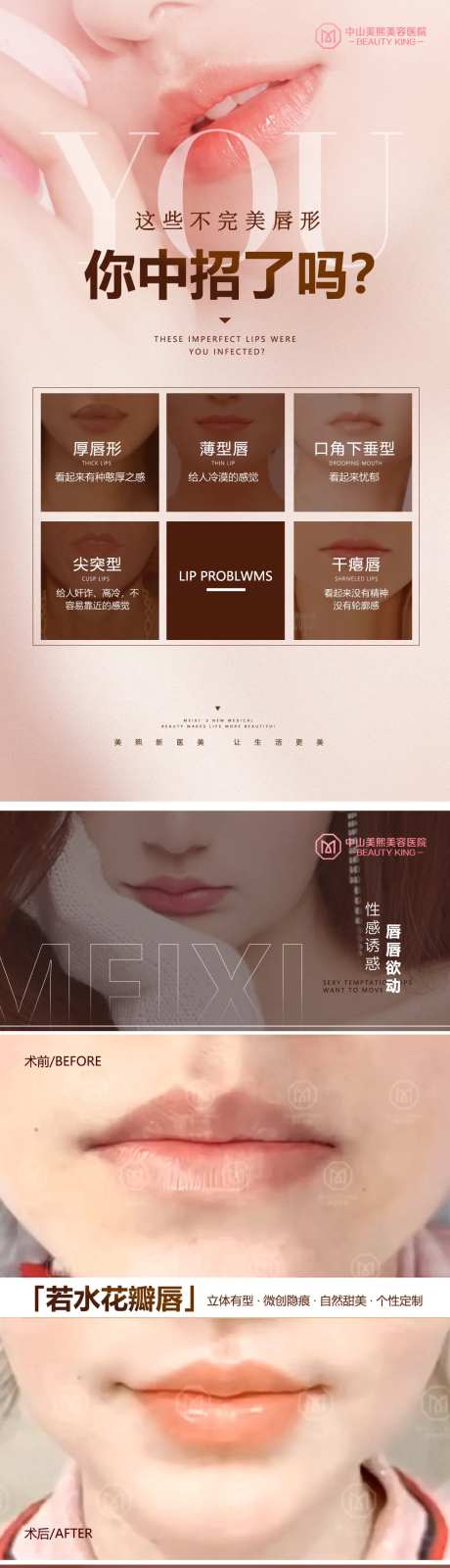 不完美唇形变美案例海报-采灵感-https://www.cailinggan.com/