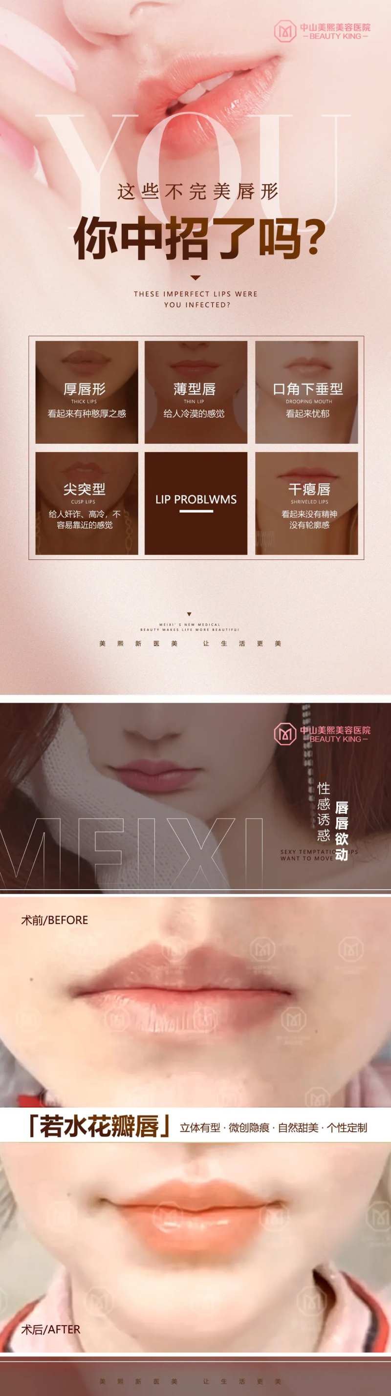 不完美唇形变美案例海报-采灵感-cailinggan.com
