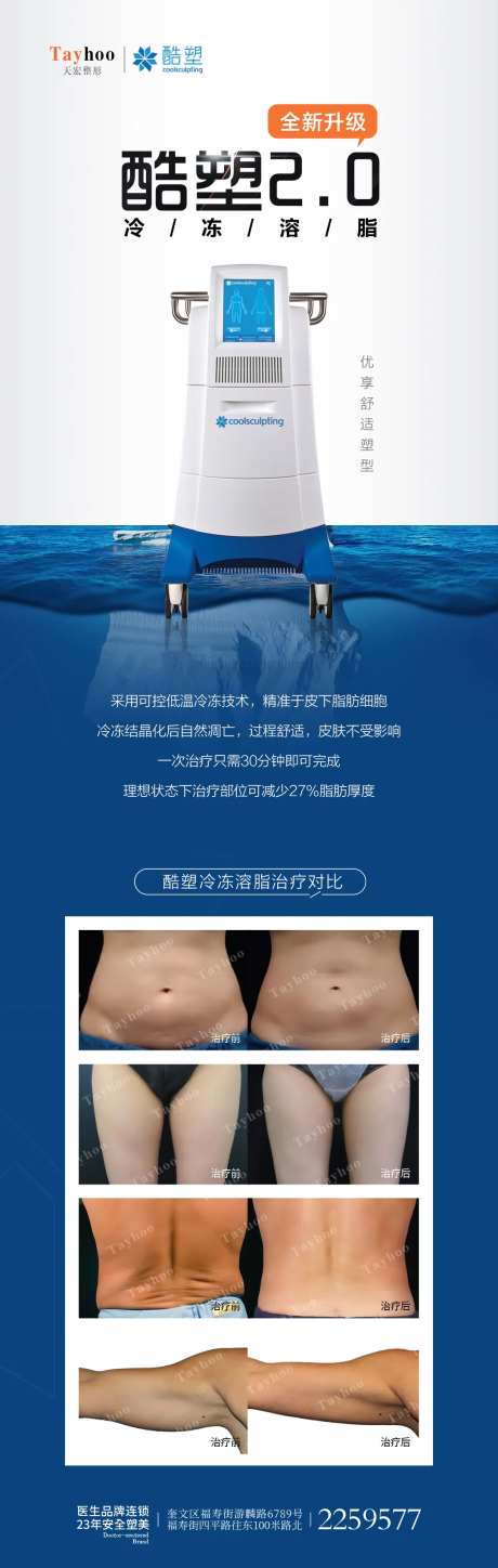 酷塑冷冻溶脂-采灵感-https://www.cailinggan.com/