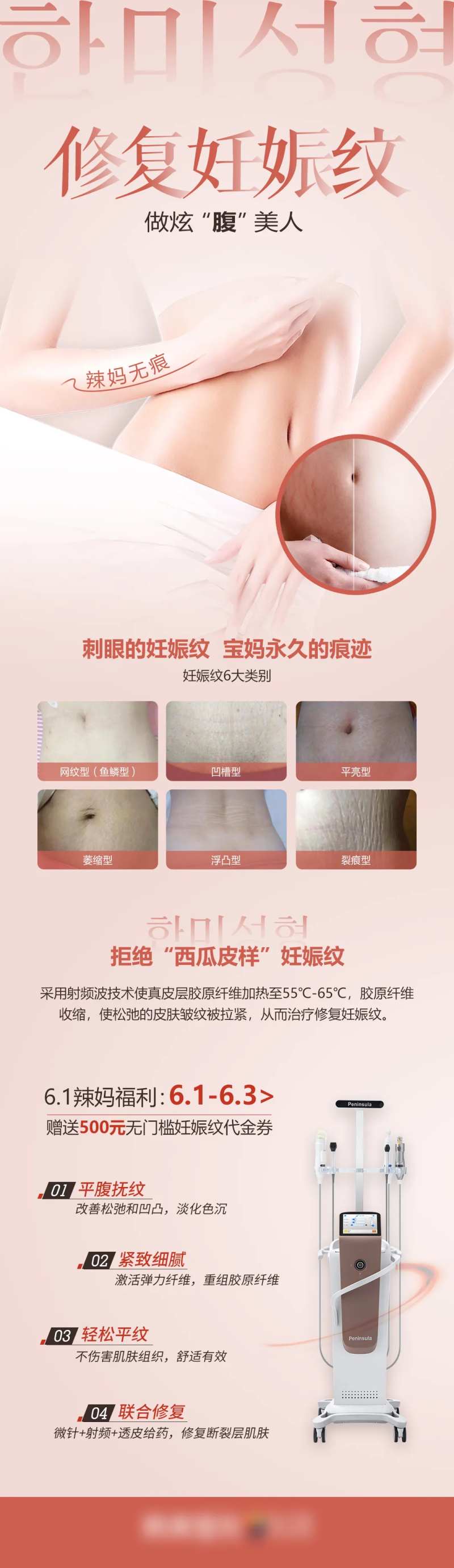 医学整形美容修复妊娠纹介绍详情-采灵感-cailinggan.com