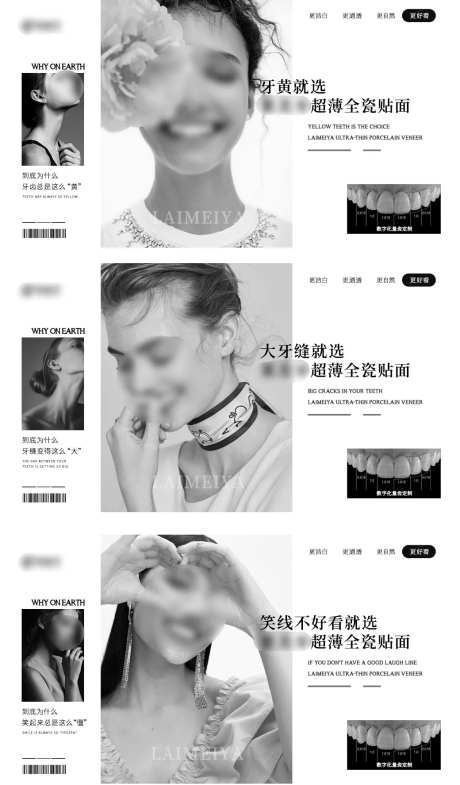 口腔美学牙齿超薄banner-采灵感-https://www.cailinggan.com/