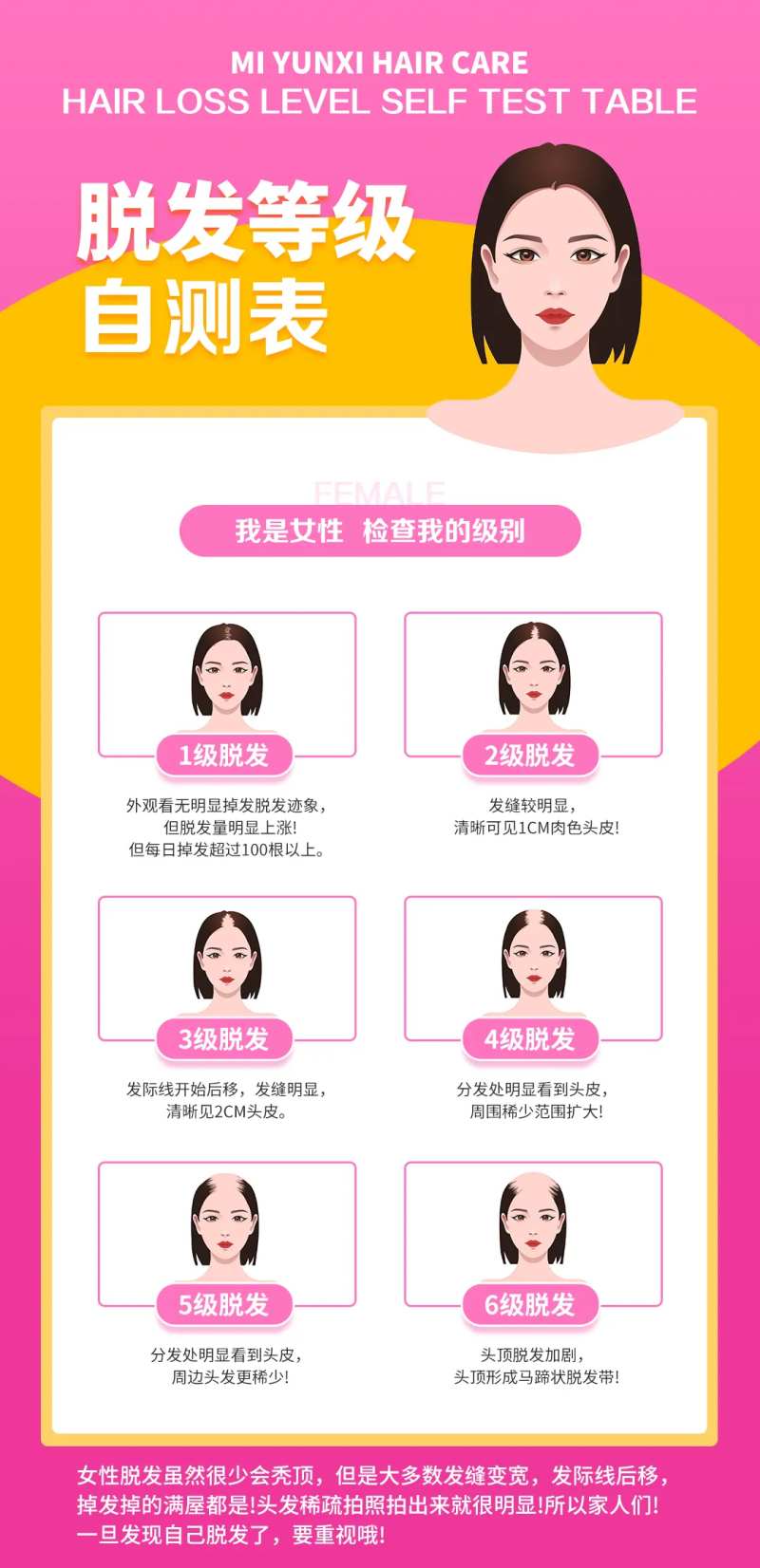 女性脱发等级-采灵感-cailinggan.com