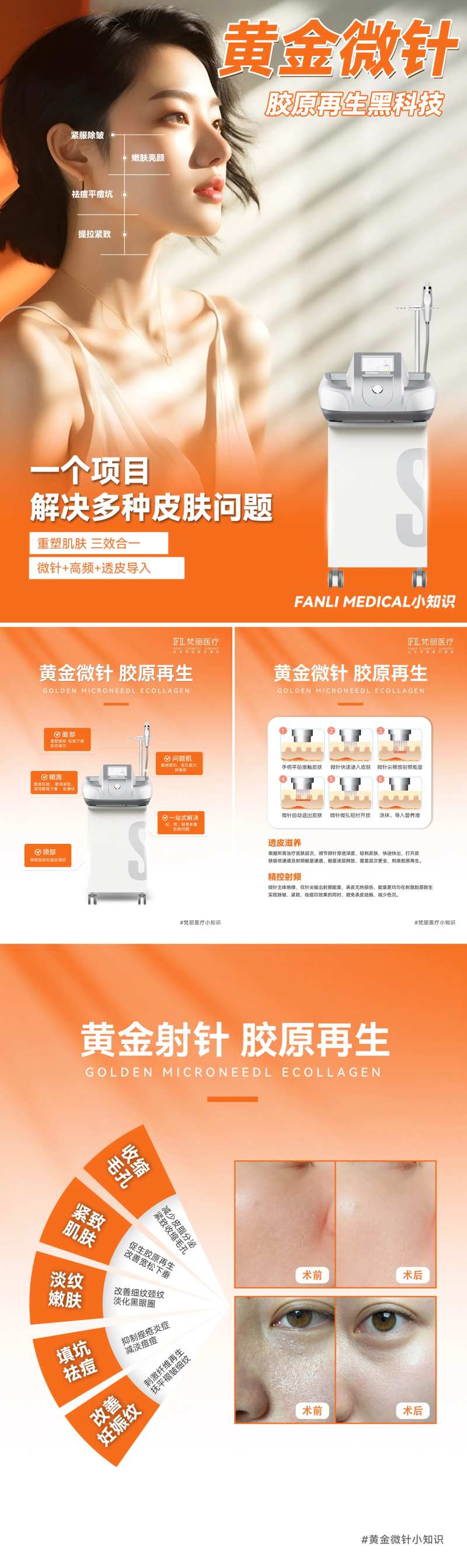 黄金微针小红书医美仪器介绍海报-采灵感-cailinggan.com