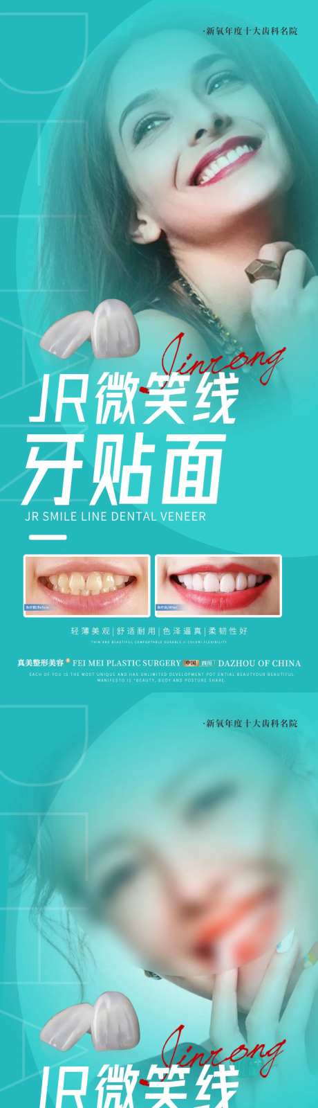 医美牙贴面案例海报-采灵感-https://www.cailinggan.com/