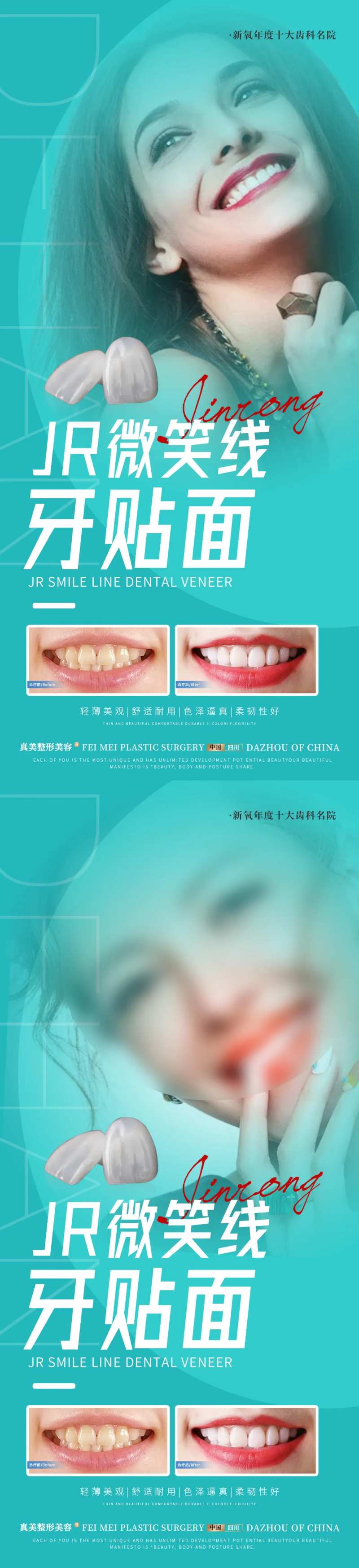 医美牙贴面案例海报-采灵感-cailinggan.com